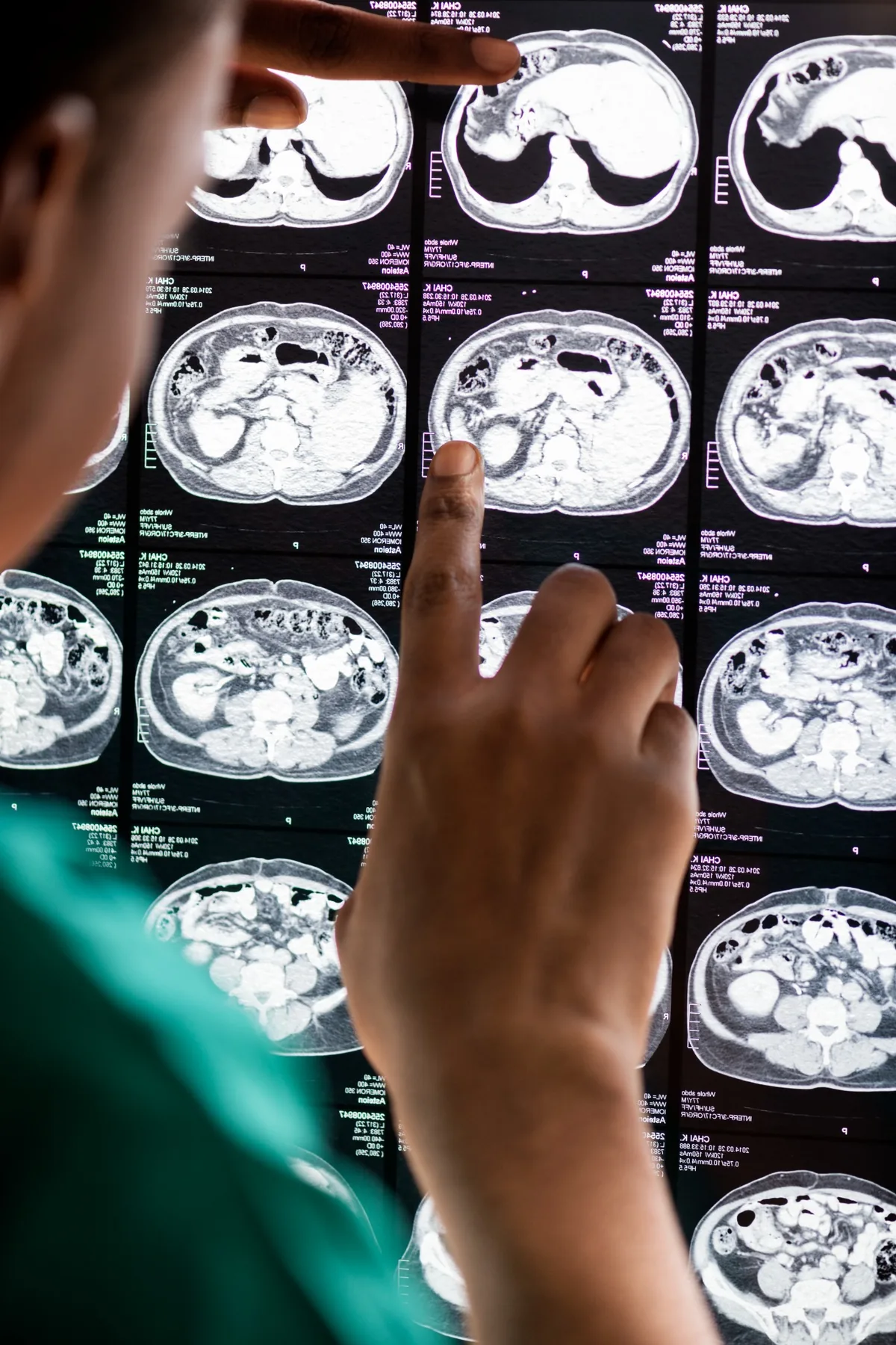 Clinician reviewing medical imaging as part of neurological care